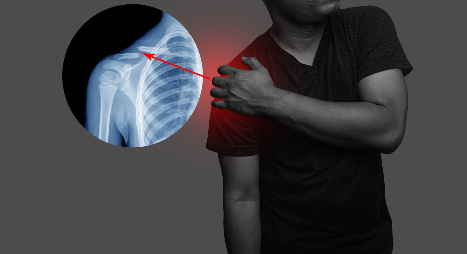 Collarbone Pain Causes, Symptoms, and Treatment Options Healthopedia UK